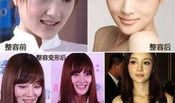 杭州整容爆料事件视频曝光,揭秘美容行业潜规则与真实案例